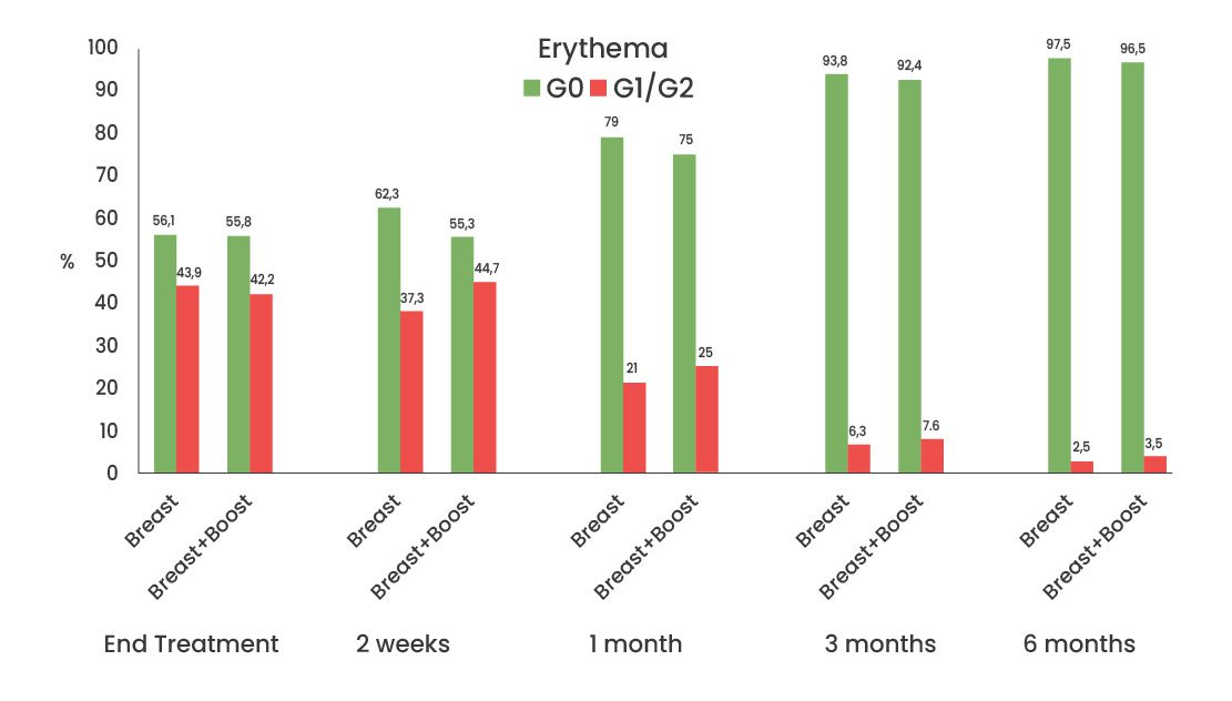 Gráfico de barras que muestra la evolución del eritema en pacientes tratados con radioterapia para el cáncer de mama, comparando la incidencia en los grupos "Breast" y "Breast+Boost" en diferentes momentos: al final del tratamiento, a las 2 semanas, 1 mes, 3 meses y 6 meses. Los resultados están desglosados en dos categorías: G0 (verde) y G1/G2 (rojo). A medida que pasa el tiempo, los porcentajes de G0 aumentan, especialmente en los 3 y 6 meses, mientras que G1/G2 disminuyen significativamente.